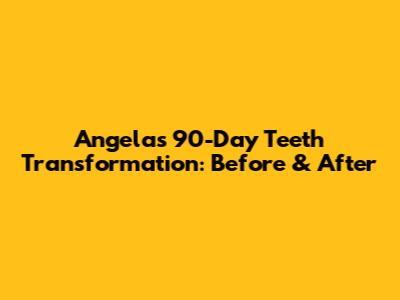 Angela's 90-Day Teeth Transformation: Before & After